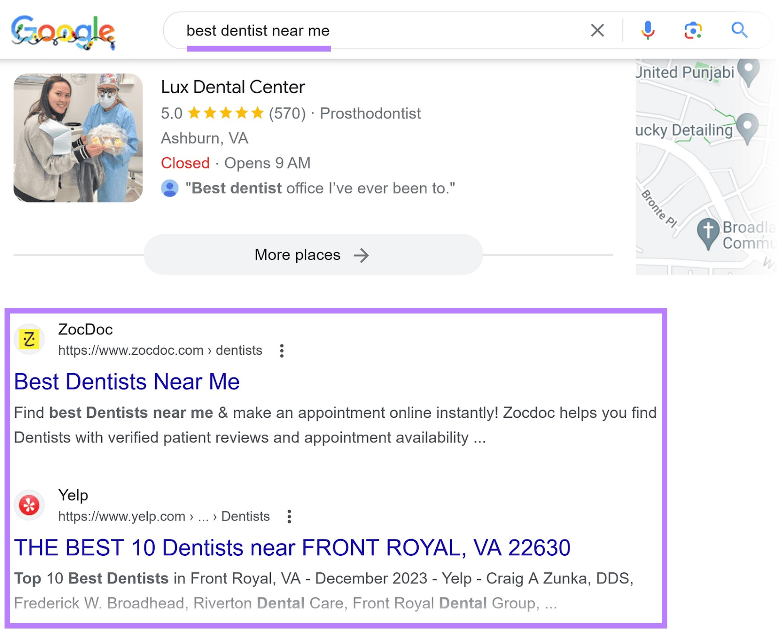 ZocDoc and Yelp organic results for "best dentist near me" query