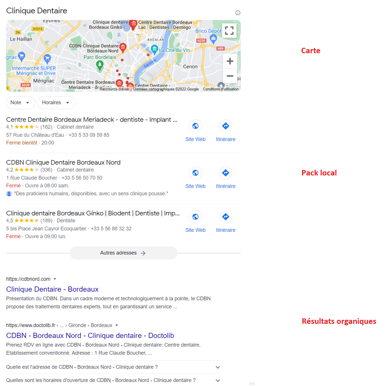 Résultats locaux Google : 3 types