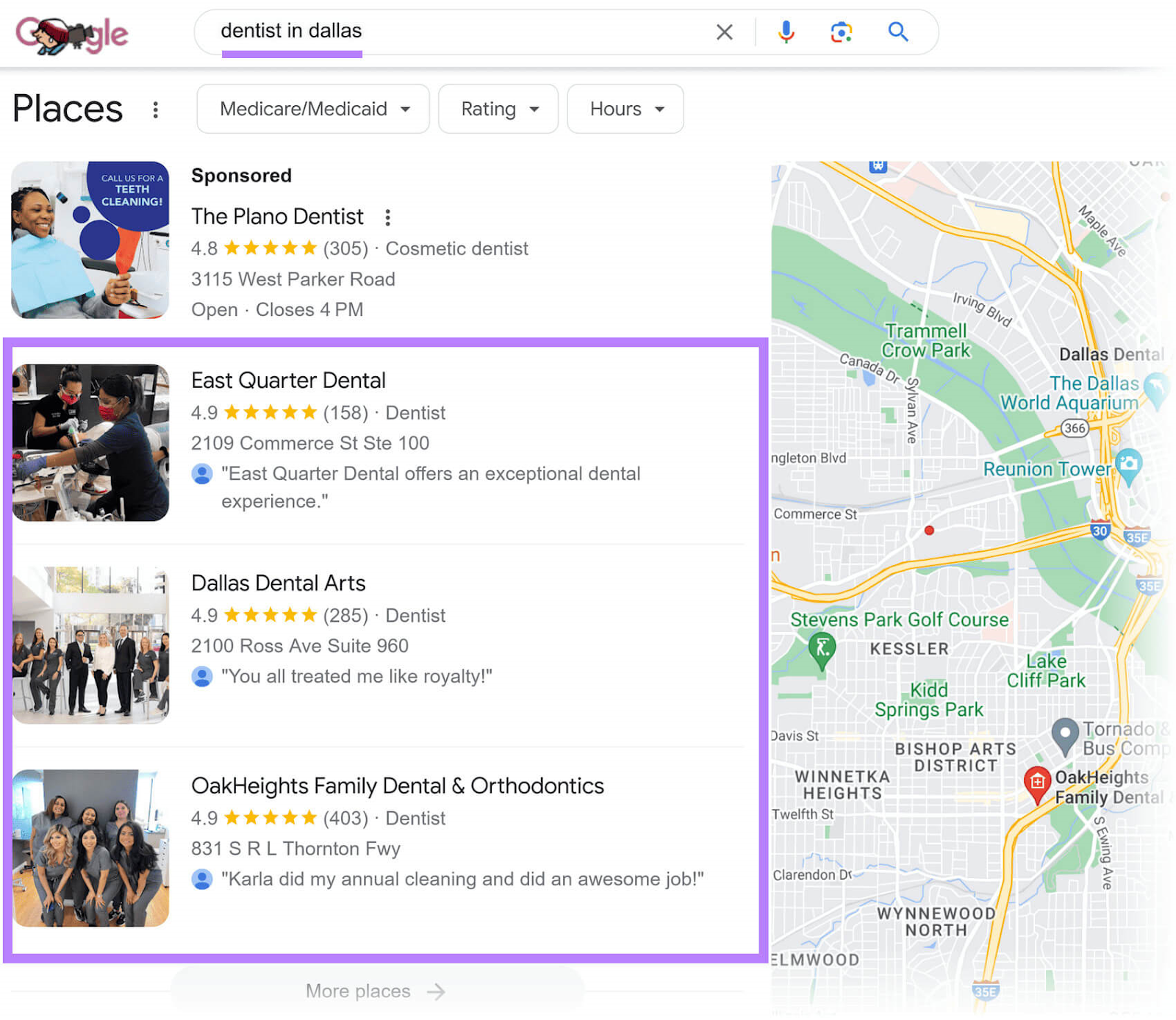 Google local pack results for "dentist in dallas" query