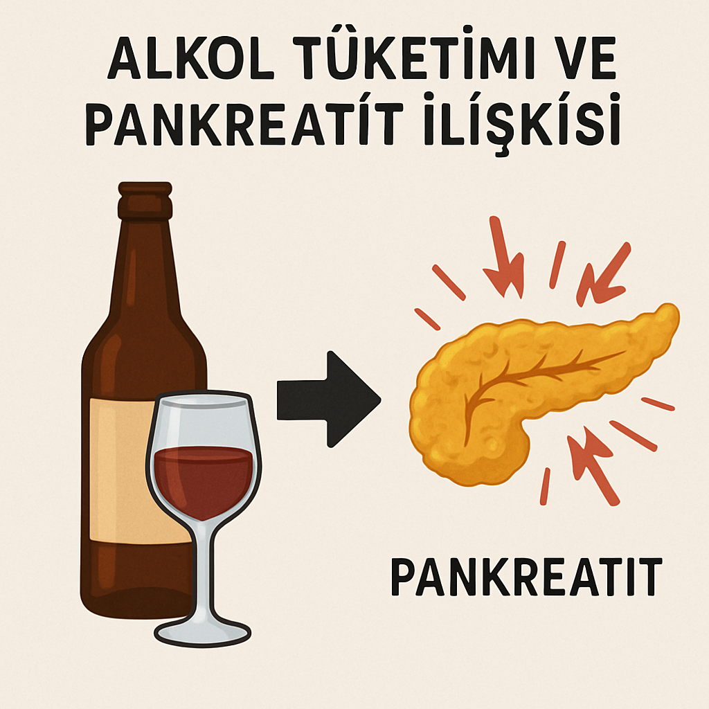 Alkol tüketimi ve pankreatit ilişkisi