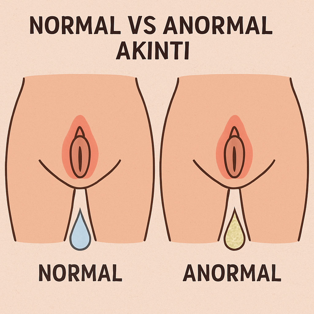 Normal vs Anormal Akıntı