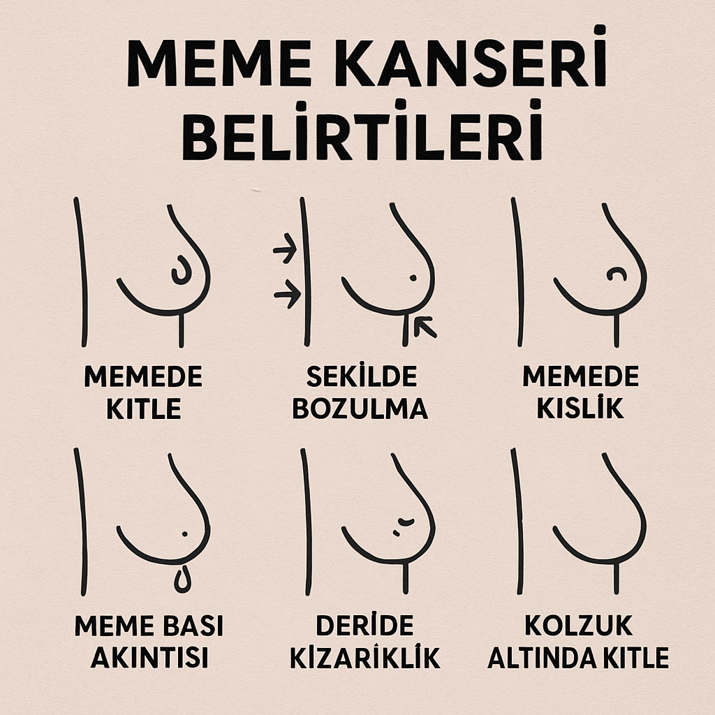 Meme kanseri belirtileri